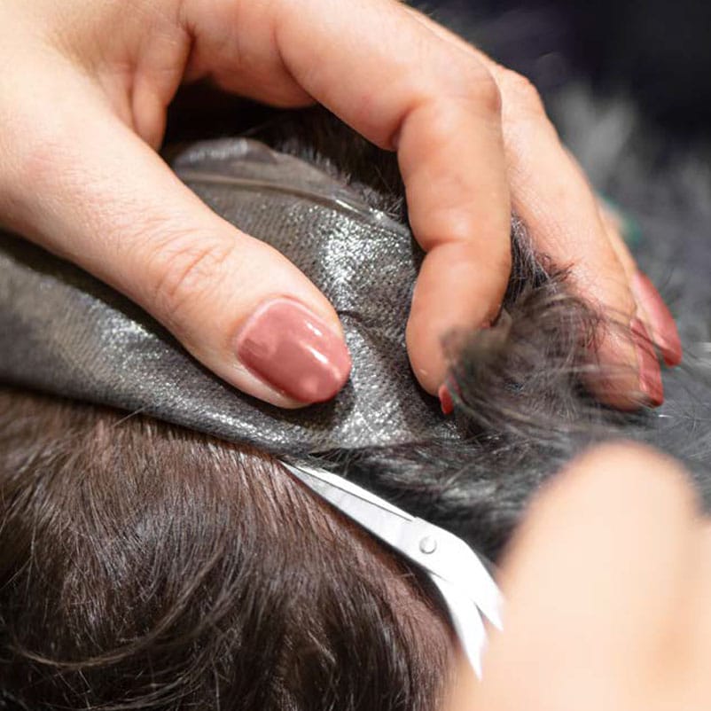 wingens haarwerken stefan mannelijke kaalheid oplossing in slechts 1,5 uur